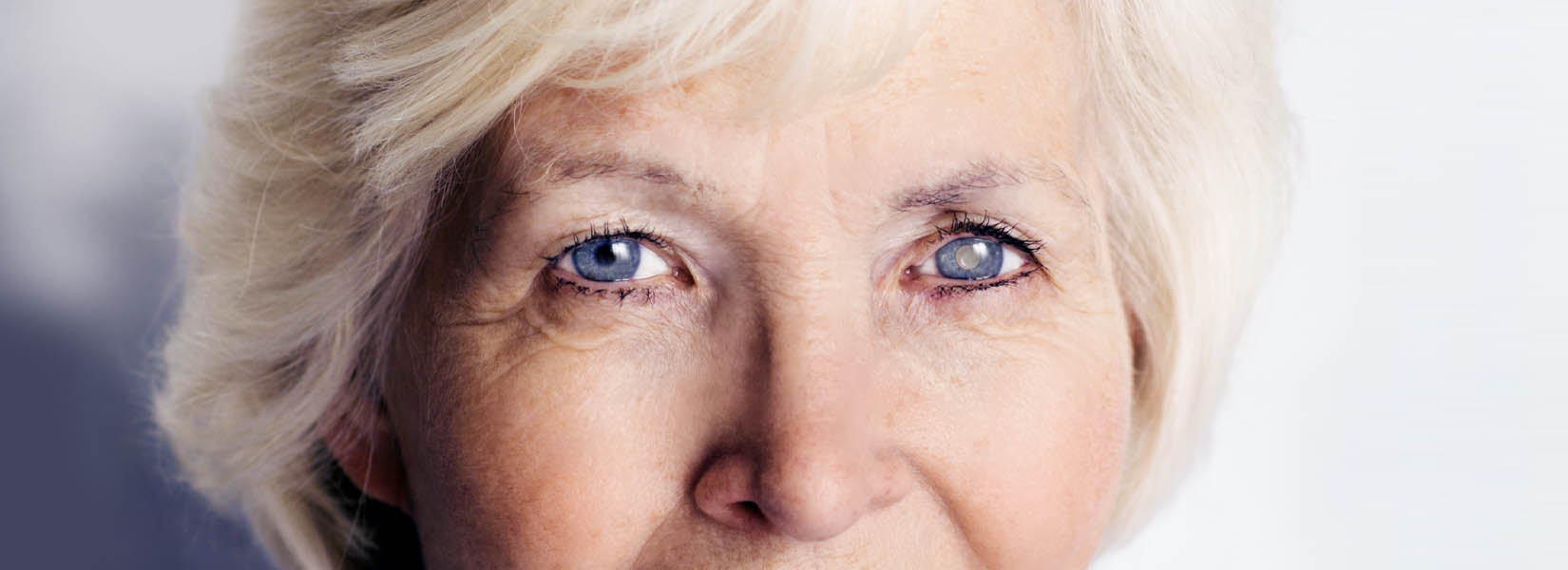 Cataract Surgery in River North